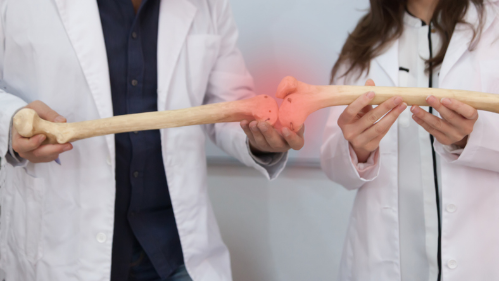 Doc and resident holding replica of two bones